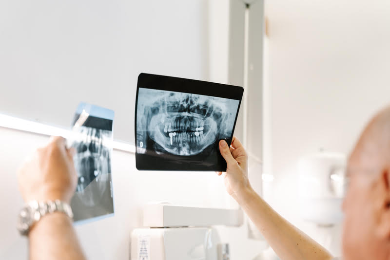 A dental professional showing an X-ray of a patient's teeth