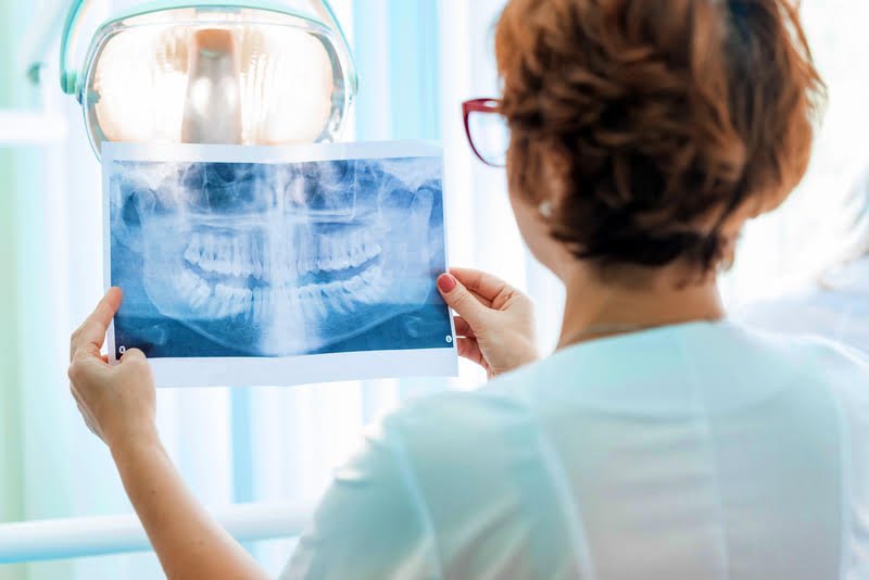 A woman examining an X-ray of her teeth during a dental check-up