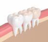 What are Dental Inlays and Onlays? - Farnham Dentistry Jacksonville